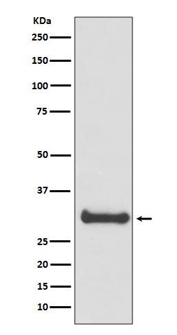 Calbindin Rabbit mAb