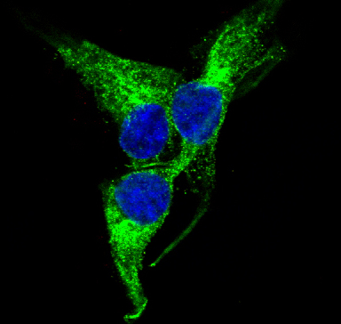 PGP9.5 Rabbit mAb