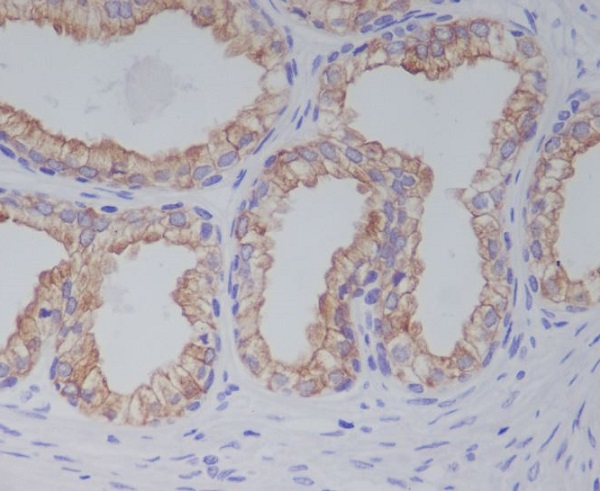 PGP9.5 Rabbit mAb