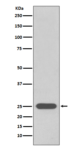 PGP9.5 Rabbit mAb