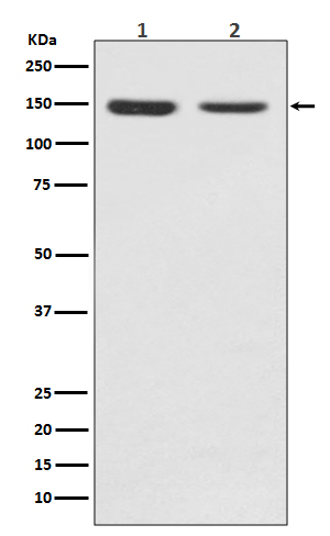 FGFR2 Rabbit mAb