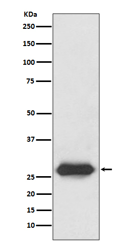 Lin28 Rabbit mAb