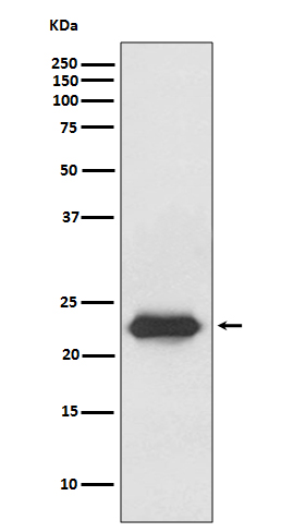 Lipocalin-2 Rabbit mAb