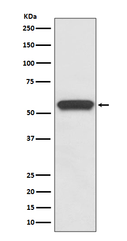 Aromatase Rabbit mAb