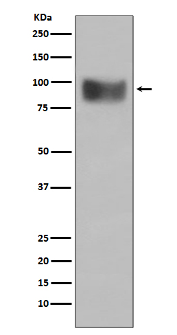 Interferon Receptor alpha Rabbit mAb