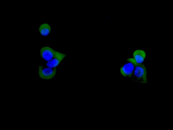 CD59 Rabbit mAb