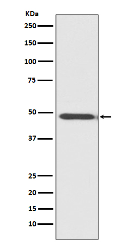 MyoD1 Rabbit mAb