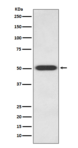 Endothelin B Receptor Rabbit mAb