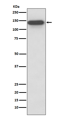 SMC3 Rabbit mAb