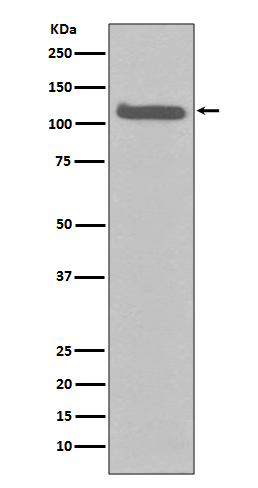 FGFR3 Rabbit mAb