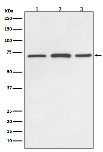 SDHA Rabbit mAb