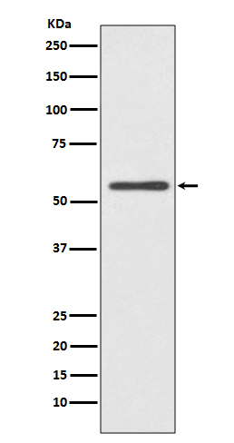 CYP2E1 Rabbit mAb