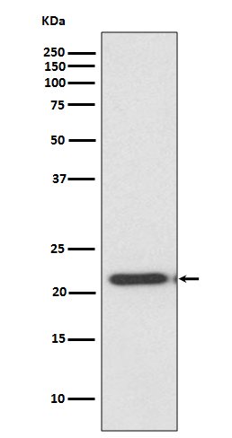 TIMP2 Rabbit mAb