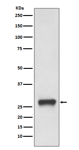 MHC Class II Rabbit mAb