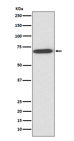 Perilipin A Rabbit mAb