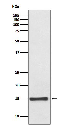 FABP4 Rabbit mAb