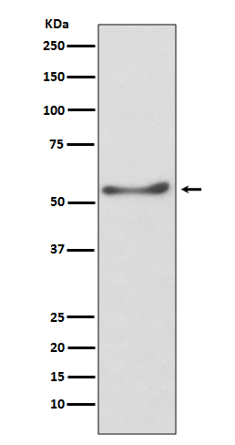 ATP5A1 Rabbit mAb