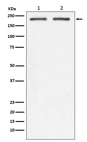 Integrin beta 4 Rabbit mAb