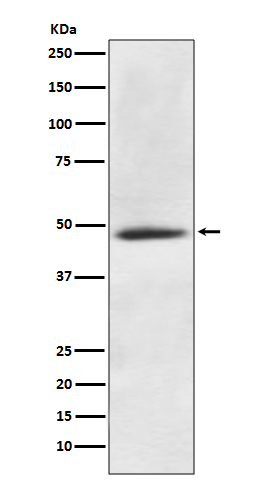 CaMKII alpha Rabbit mAb