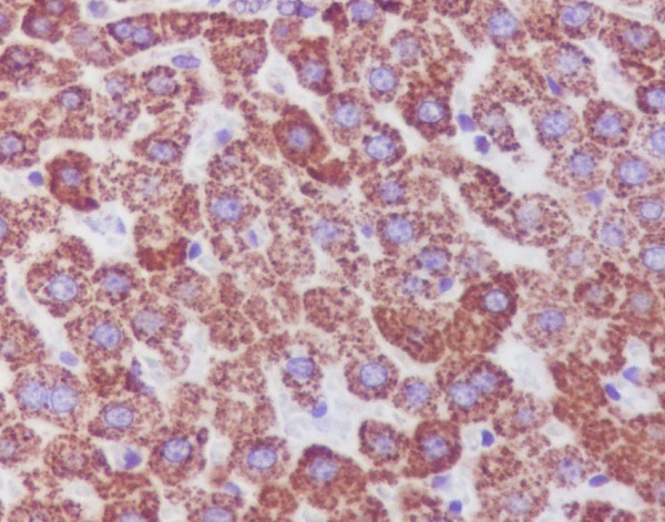 Catalase Rabbit mAb