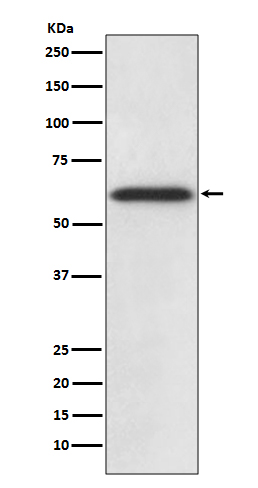 Catalase Rabbit mAb