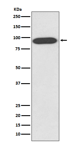 VCP Rabbit mAb