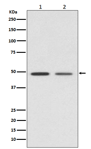 Vitamin D Receptor Rabbit mAb