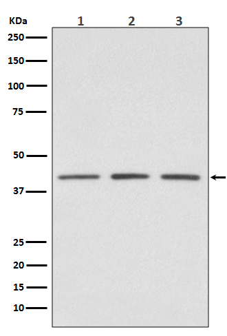 PRMT1 Rabbit mAb