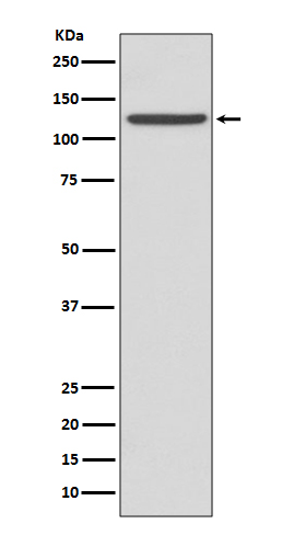 CD41 Rabbit mAb