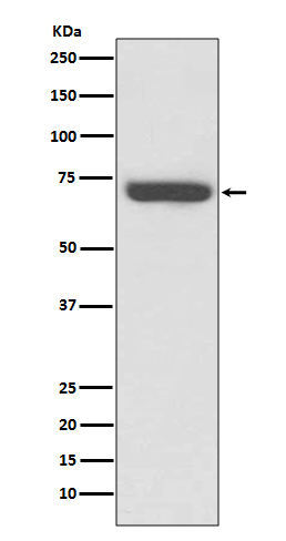 TNF Receptor II Rabbit mAb