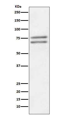 ADAM10 Rabbit mAb