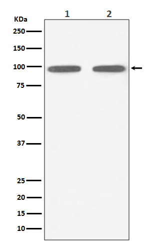 FGFR3 Rabbit mAb