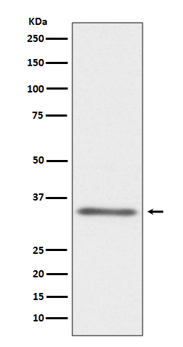 CD40L Rabbit mAb