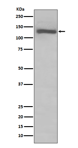 TLR7 Rabbit mAb