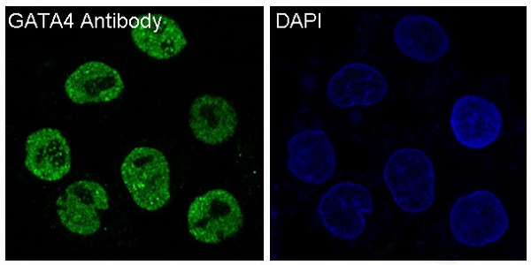 GATA4 Rabbit mAb