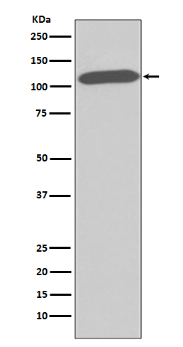 CD26 Rabbit mAb