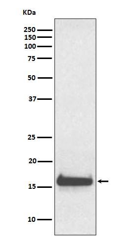 TTR Rabbit mAb