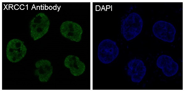 XRCC1 Rabbit mAb