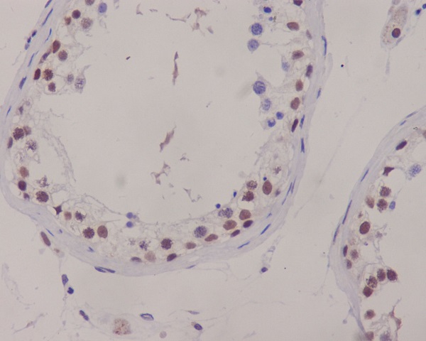 XRCC1 Rabbit mAb