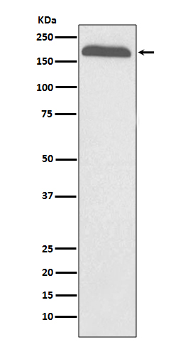 A2M Rabbit mAb