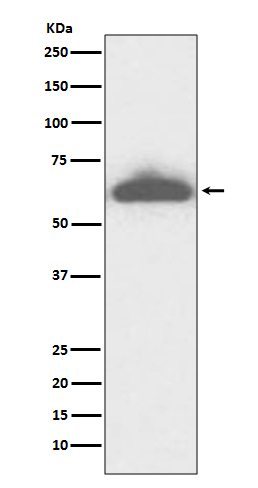 RPE65 Rabbit mAb