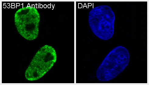 53BP1 Rabbit mAb