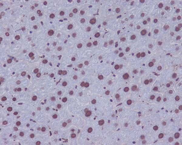 53BP1 Rabbit mAb