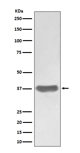 SFRP1 Rabbit mAb