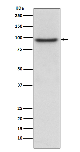 PROX1 Rabbit mAb