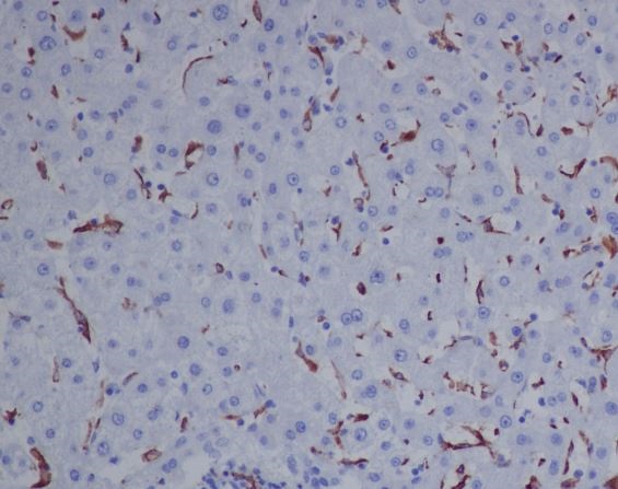 CD163 Rabbit mAb