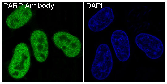 PARP Rabbit mAb