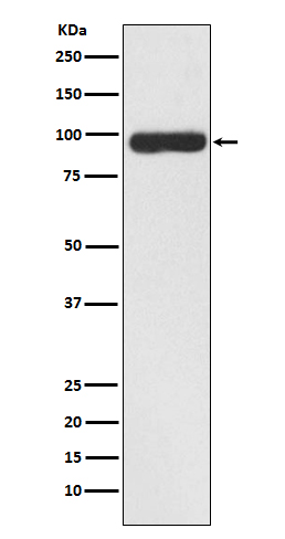 FAP1 Rabbit mAb