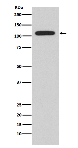 NFAT2 Rabbit mAb