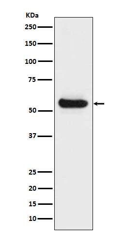 Lipoprotein lipase Rabbit mAb